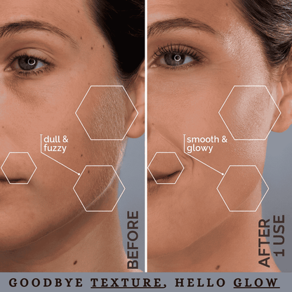 Silkglow™ Electric Facial Hair Remover